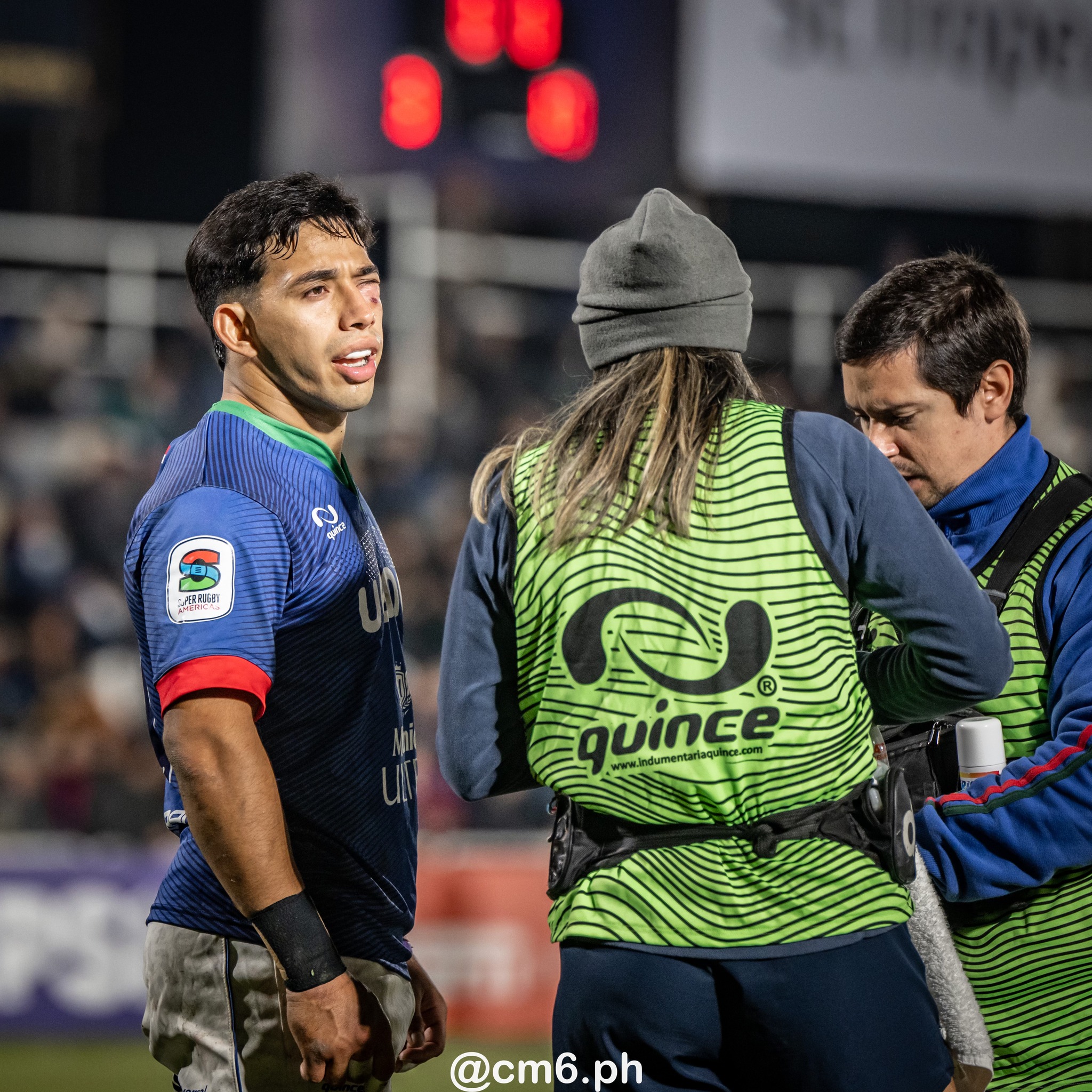  Tarucas - Yacaré XV - Rugby - SRA 2025 - Fecha 14 - Tarucas (44) vs (24) Yacares (#SRA25F14TAYA6) Photo by: Christian Mas | Siuxy Sports 2025-06-01